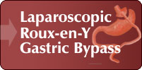 Laparoscopic Roux-en-Y Gastric Bypass, London UK